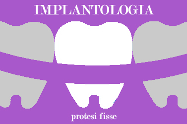 implantologia dentale impianto dentale fisso e mobile