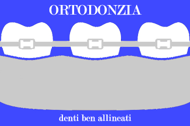 Ortodonzia dentale apparecchio ortodontico per denti storti